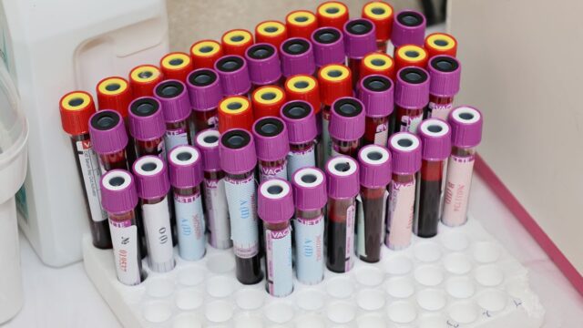 Лаборант берёт кровь на анализ в Казани